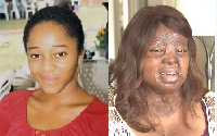 Kechi Okwuchi survived the Sosoliso air accident in 2005