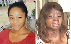 Kechi Okwuchi survived the Sosoliso air accident in 2005
