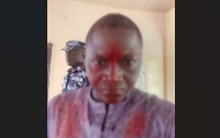 A blurred photo of Mohammed Adamu after the assault