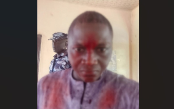 A blurred photo of Mohammed Adamu after the assault